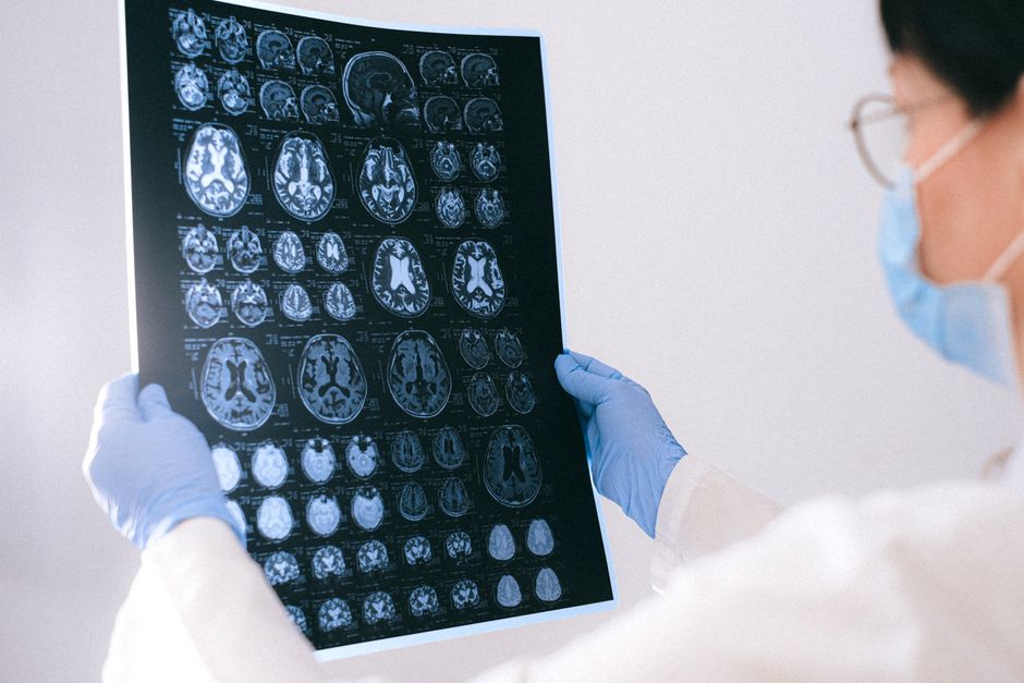 A doctor reviewing MRI brain scans on a lightbox in a clinical setting